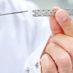 Realizan en el país una novedosa intervención cardíaca en un paciente joven
